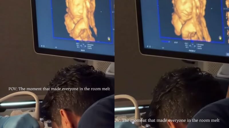Bebê sorri ao ouvir a voz do pai durante ultrassom 3D e vídeo emociona milhões