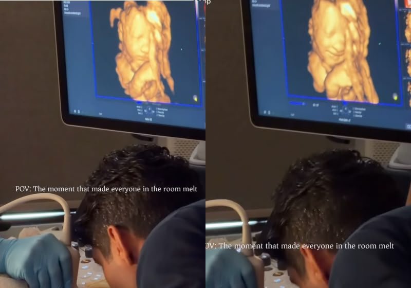Bebê sorri ao ouvir a voz do pai durante ultrassom 3D e vídeo emociona milhões
